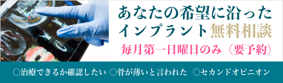 インプラント相談